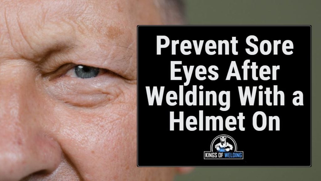 What Helps Burning Eyes From Welding